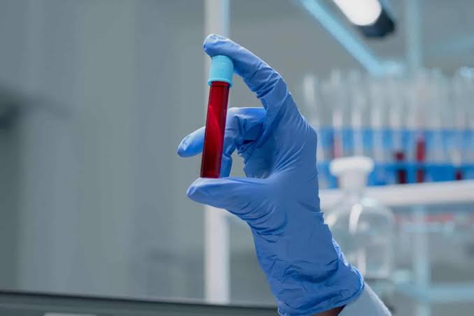 9 Questions About Blood Test Results From Your UK GP